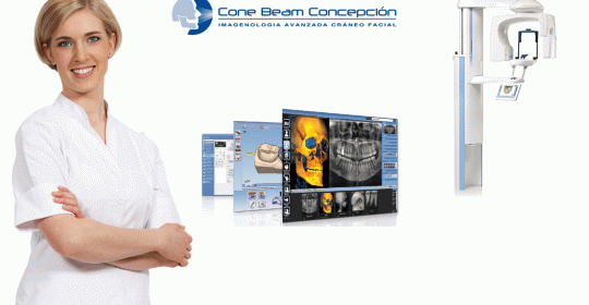 Cone Beam Concepción: Imagenología craneofacial avanzada