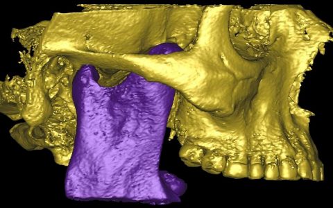 Articulación Temporo Mandibular (ATM)