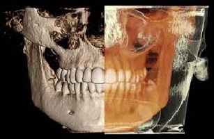 Estudios Especiales Dentales